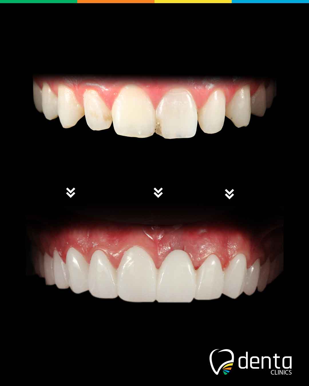Before & After