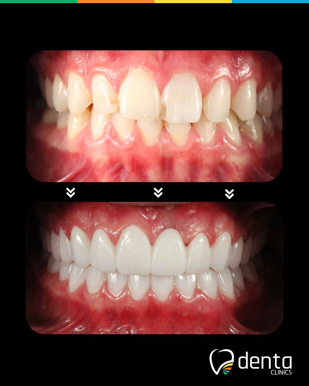 j3