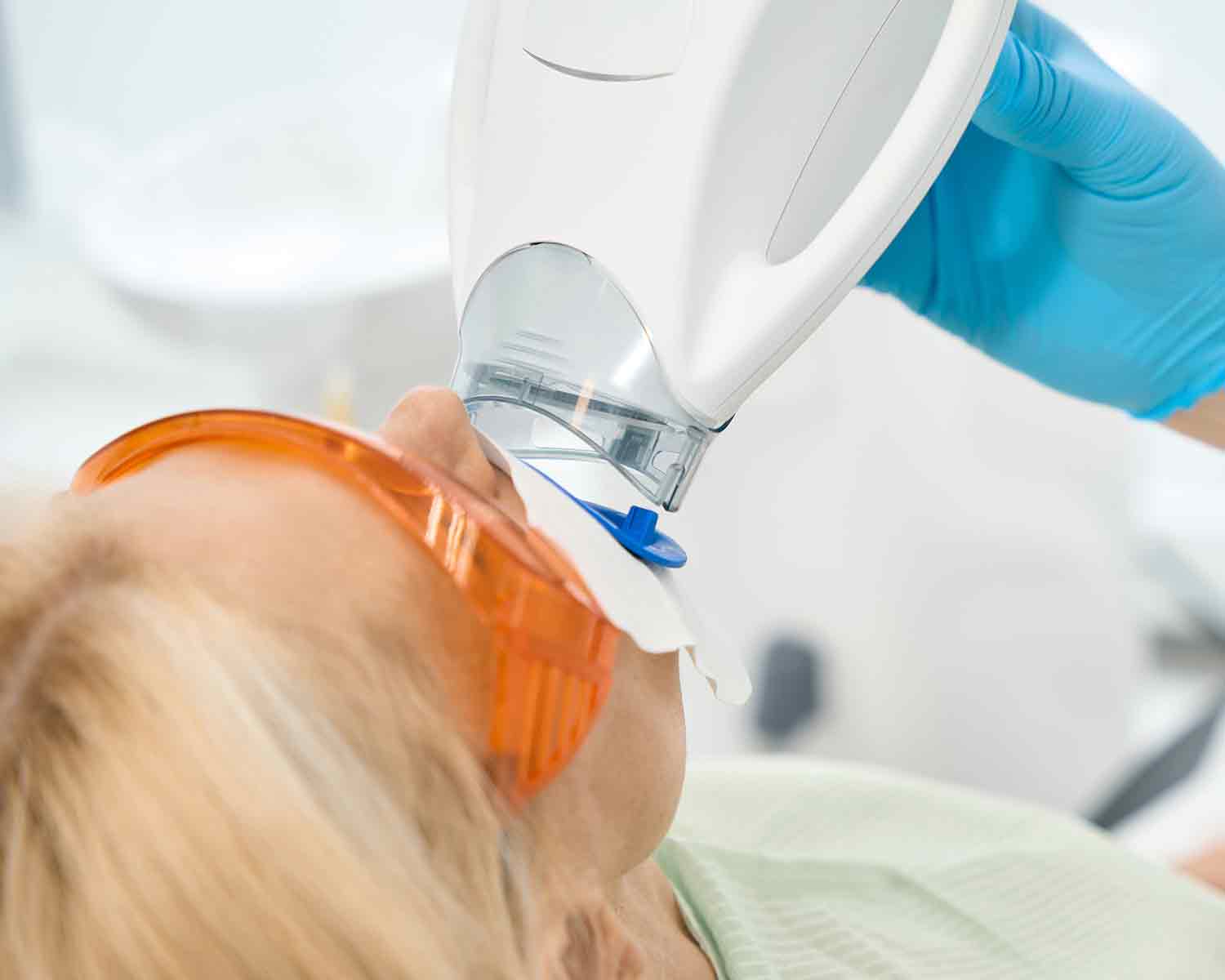 teeth-whitening-cover-denta-antalya-dental-care-antalya-3