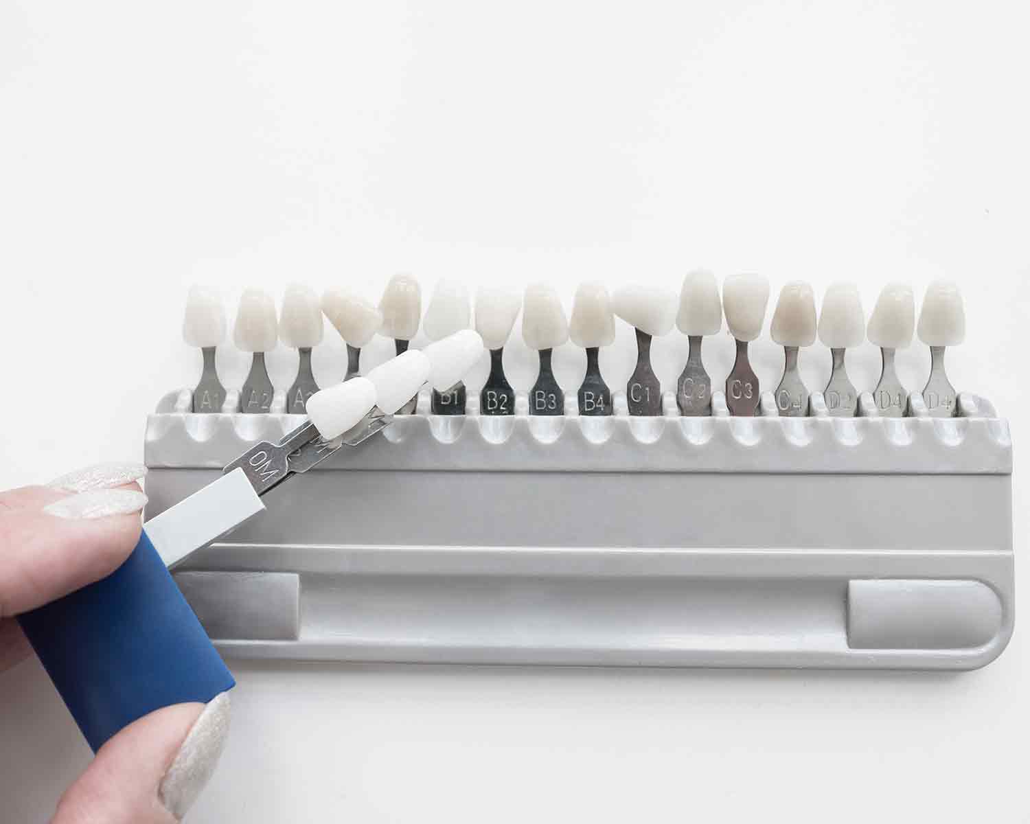 Dental Veneers