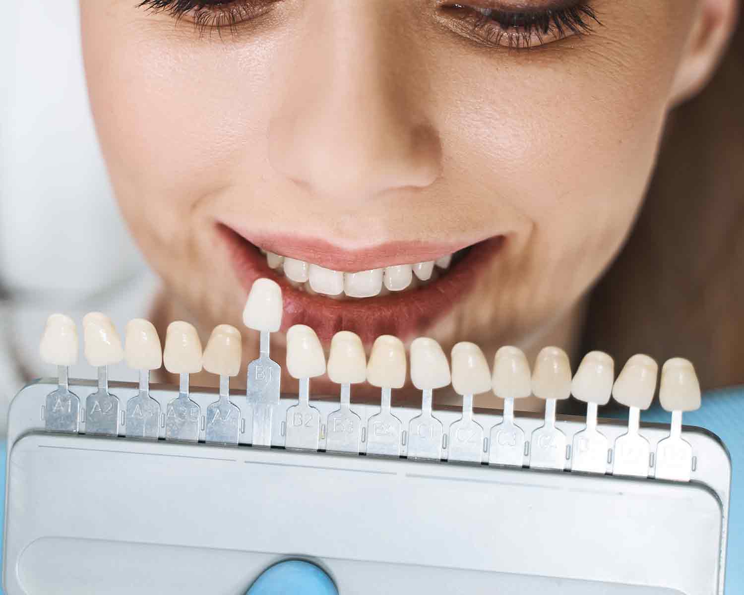 debtal-implant-Why-is-it-Preferred