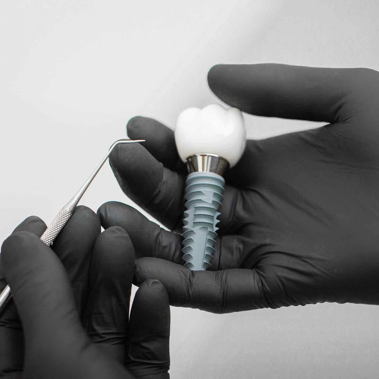 Dental Implant