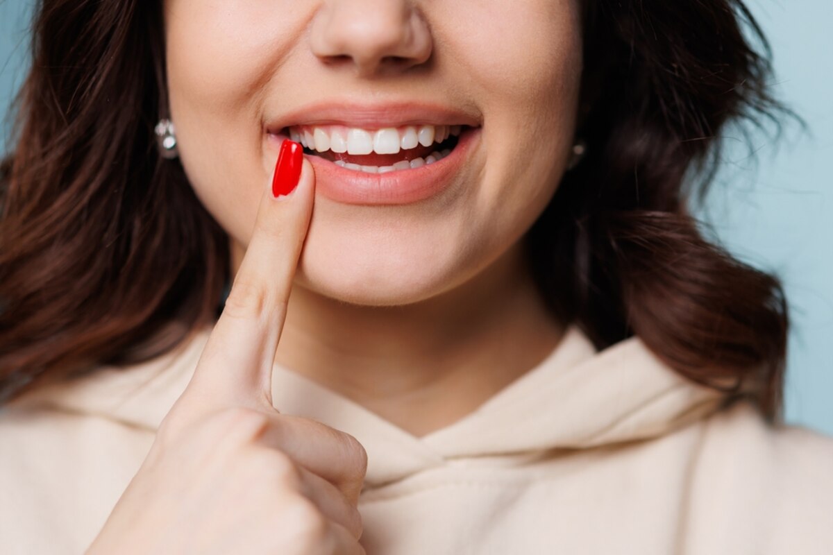 top-5-benefits-of-professional-teeth-cleaning